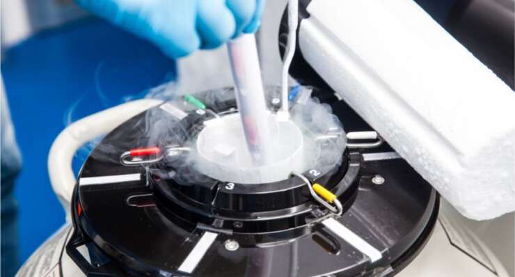 Embryo Freezing