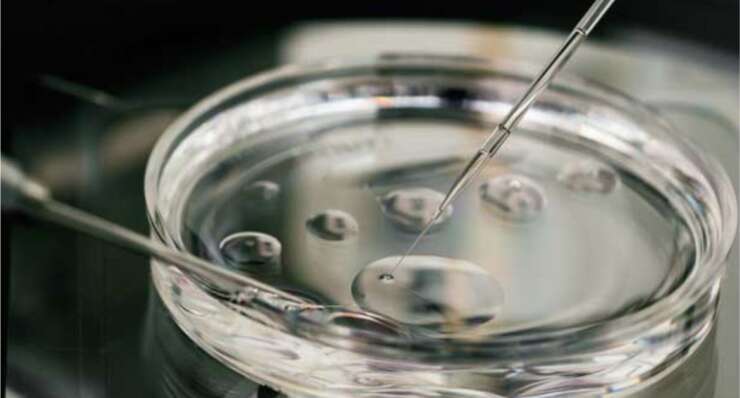 In Vitro Maturation (IVM)