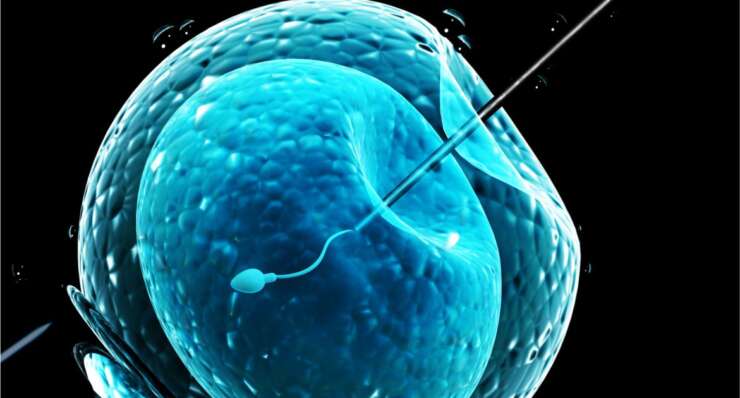 Intra Cytoplasmic Sperm Injection (ICSI)