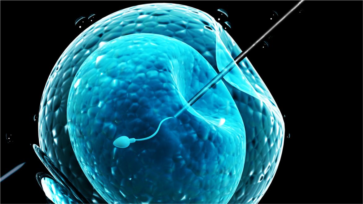 Intra Cytoplasmic Sperm Injection (ICSI)
