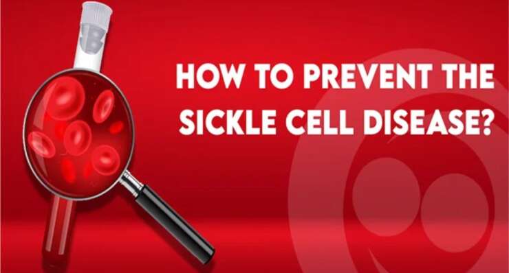 Sickle cell anemia prevention program