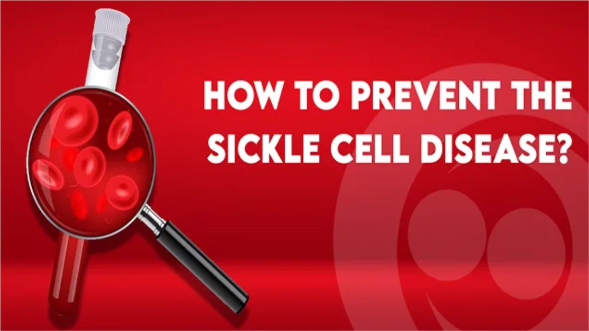 Sickle cell anemia prevention program