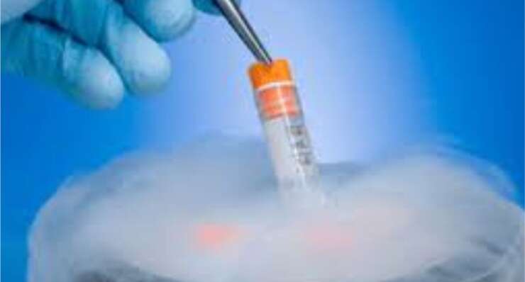 Sperm Freezing