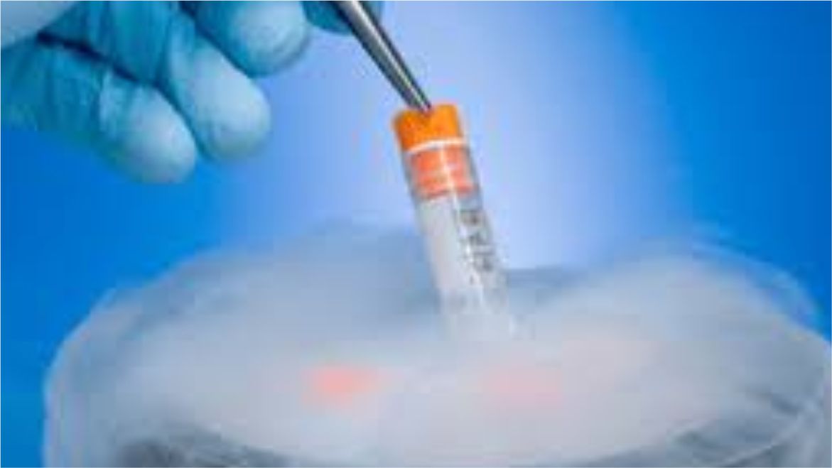 Sperm Freezing