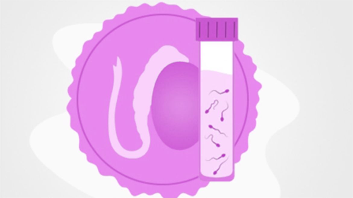 Testicular Sperm Extraction (TESE)